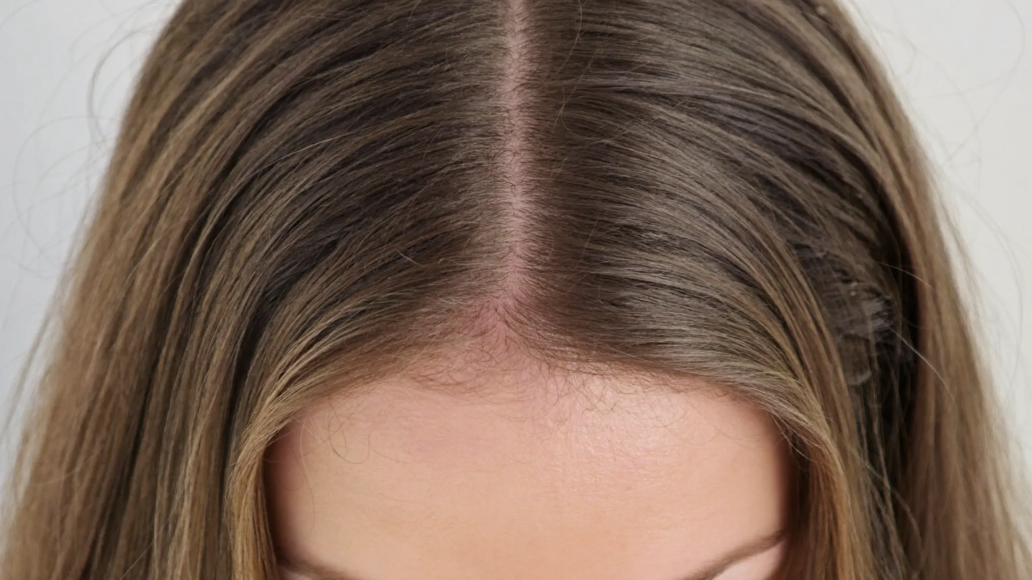 Polinucleótidos en la caída del cabello
